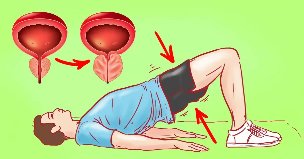 Oefening voor prostatitis