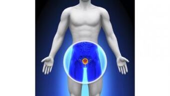 prostatitis bij een man