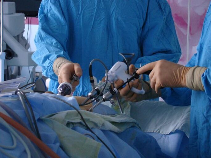 chirurgische behandeling van prostatitis
