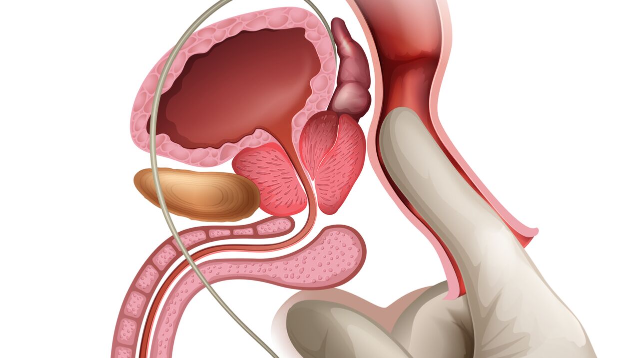 Prostaatmassage is een effectieve manier om congestieve prostatitis te behandelen